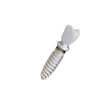 dental implants in matthews