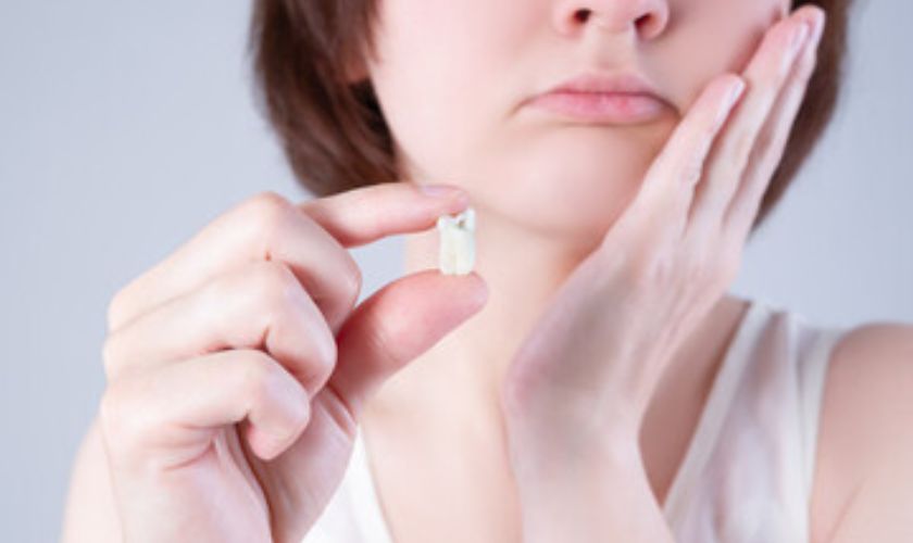 Tooth Extractions in Matthews NC