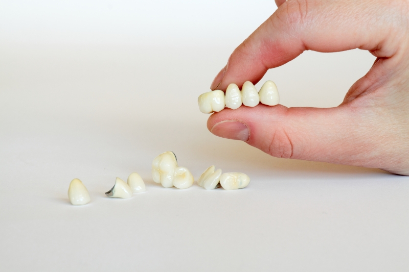 Five Essential Steps for a Broken Dental Crown