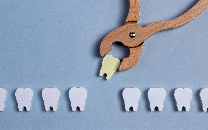 Understanding Dental Extractions and Their Impact on Adjacent Teeth