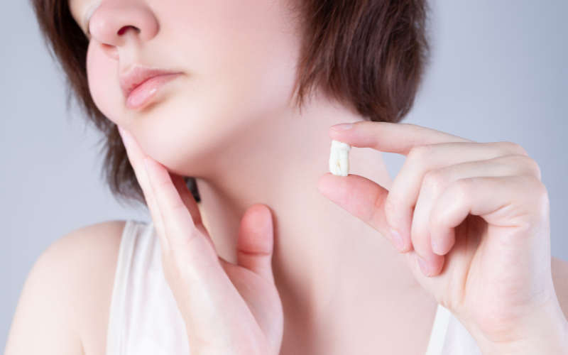 what happens to the stitches after wisdom tooth extraction