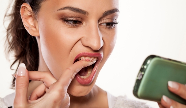 how to get rid of teeth stains
