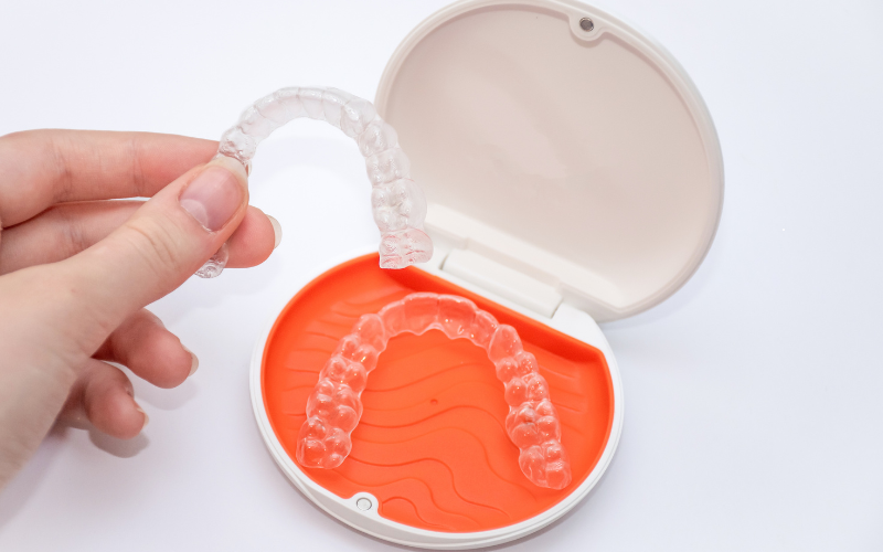 Clear Aligners