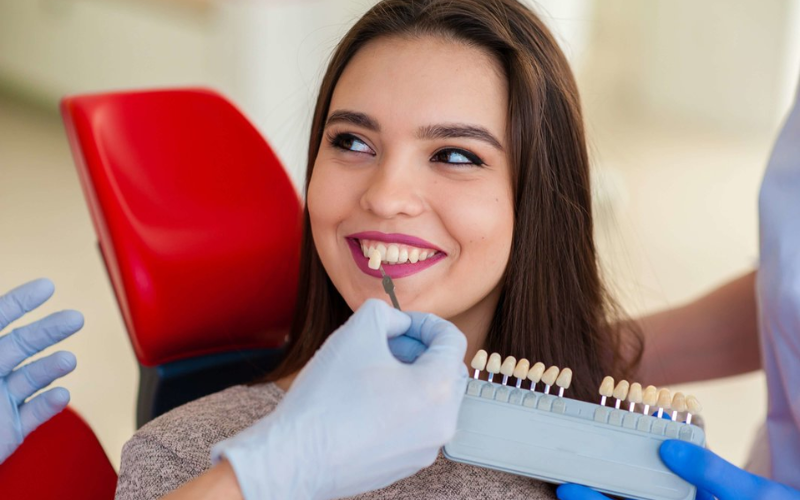 Benefits of Getting Veneers for Stained or Discolored Teeth
