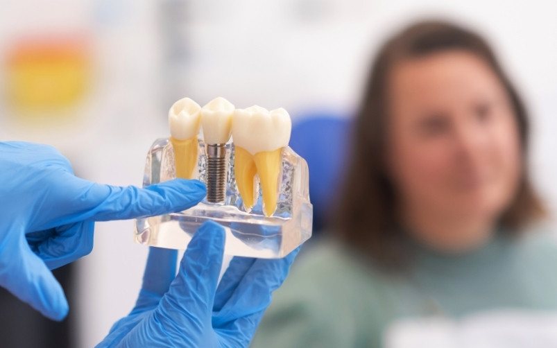 factors that affect the longevity of dental implants