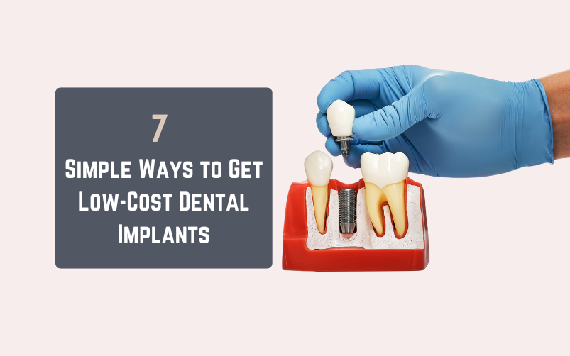 simple ways to get low-cost dental implants