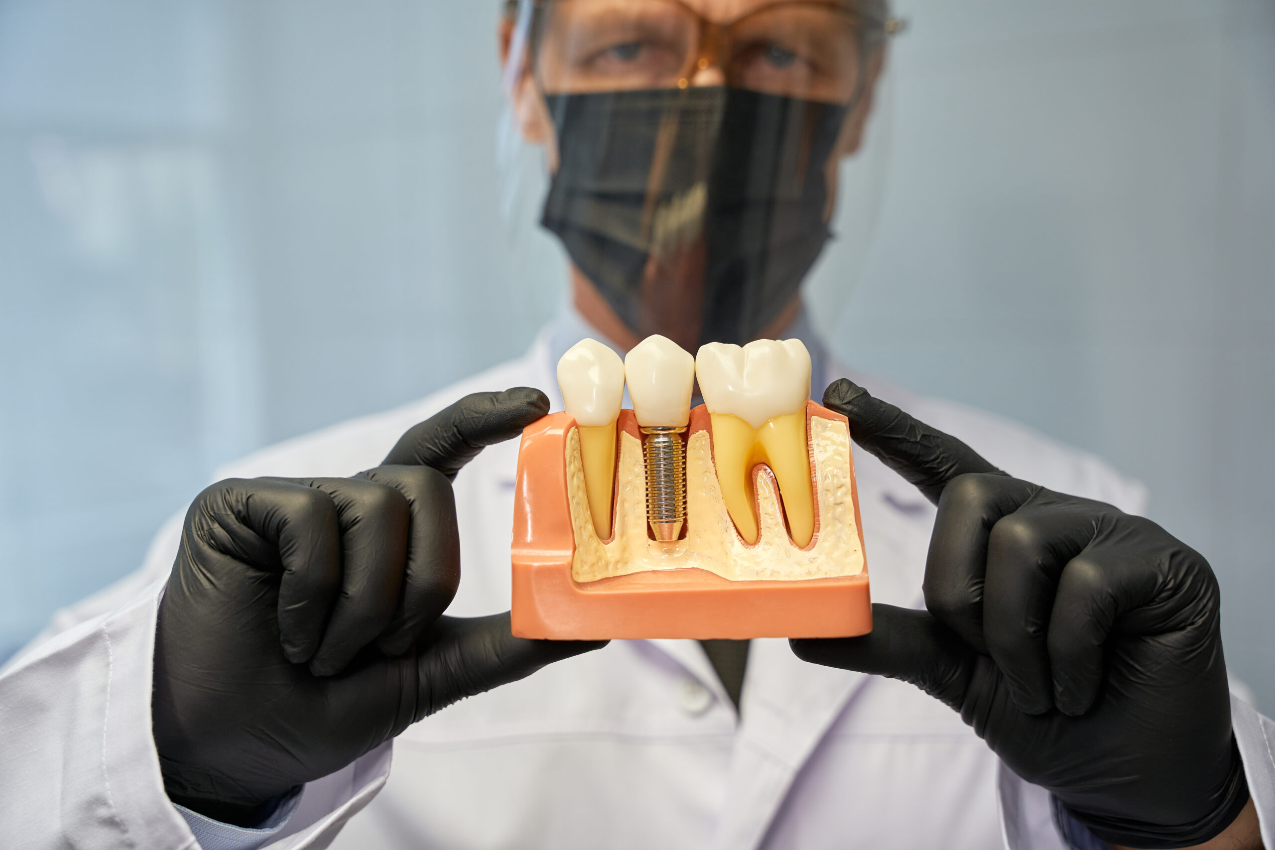 Featured image for “How Long Do Dental Crowns Last and What Affects Their Lifespan?”
