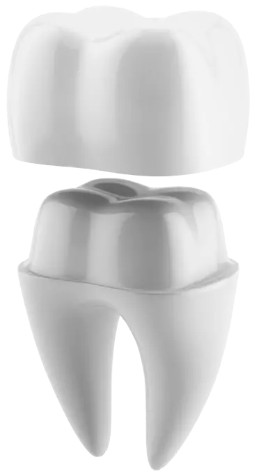 Dental Crowns in Matthews