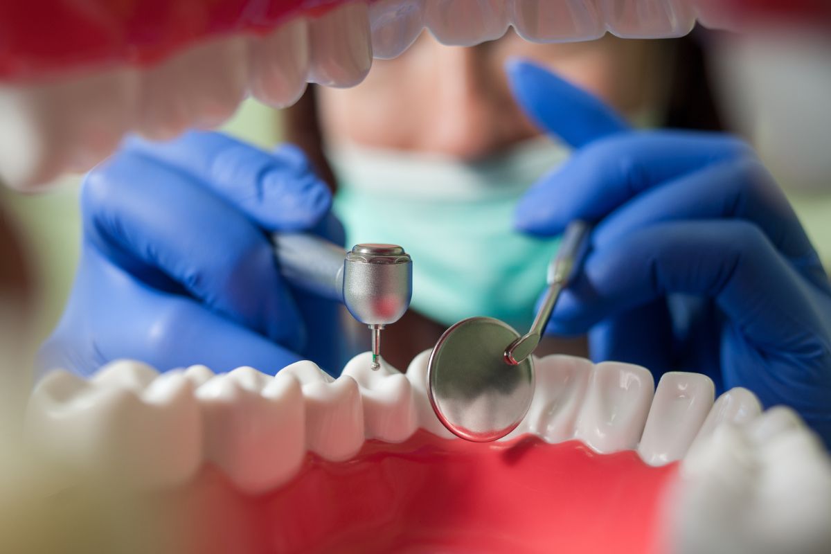 Featured image for “How Long Do Dental Fillings Last?”