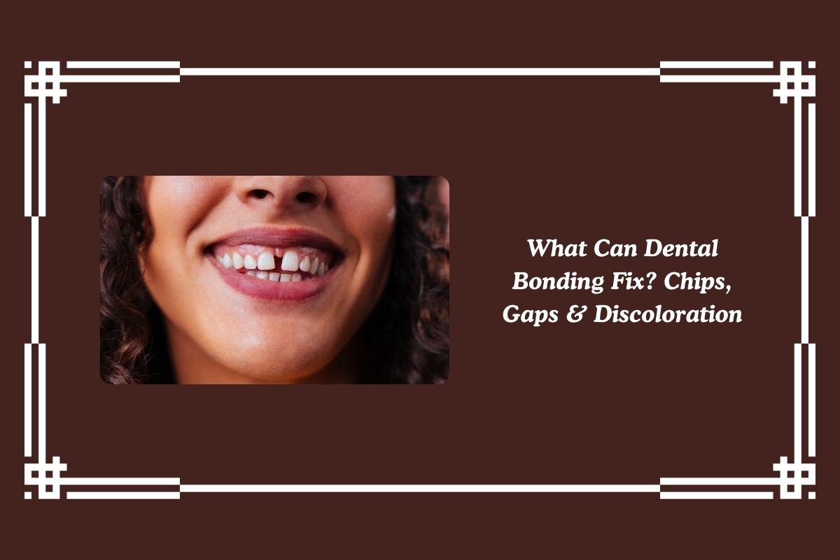 Featured image for “What Can Dental Bonding Fix? Chips, Gaps & Discoloration”