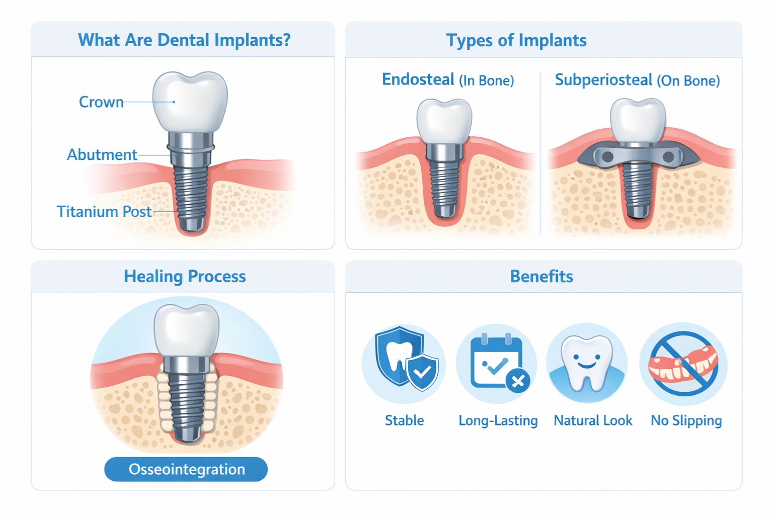 what are dental implants