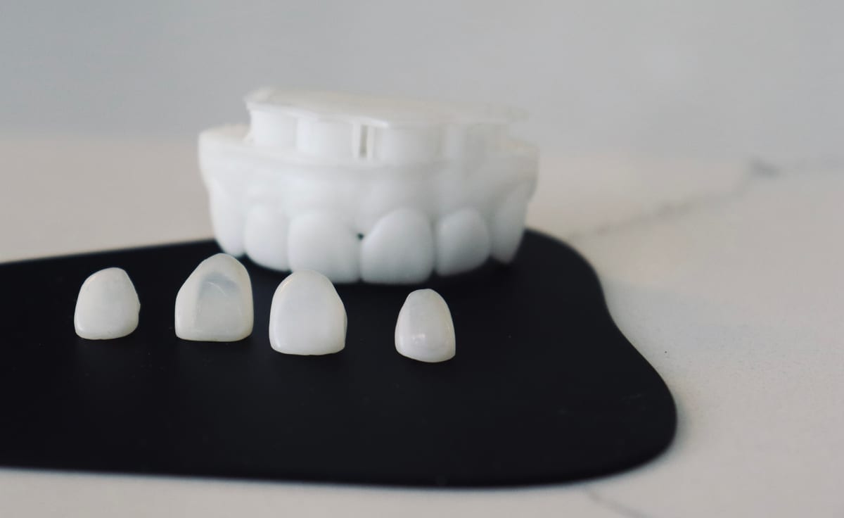 Featured image for “Veneer Placement in Matthews, NC | Dawson Modern Dentistry”