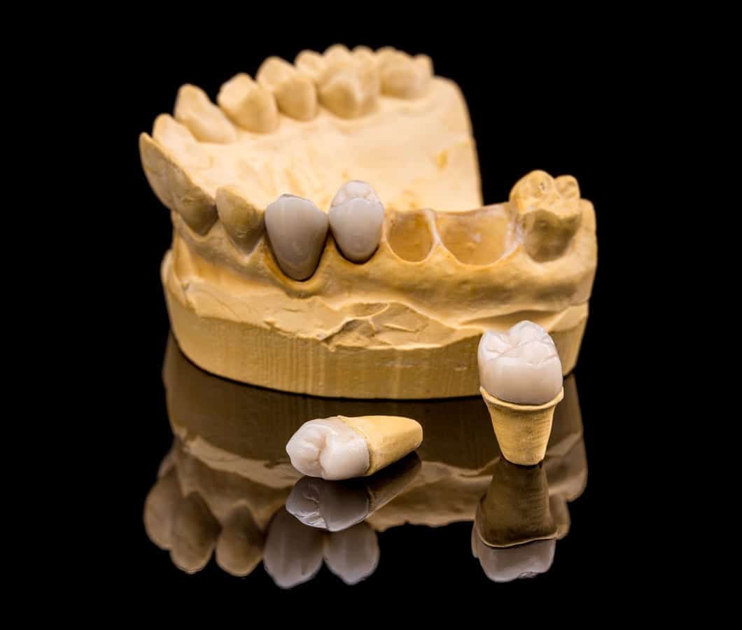 Featured image for “Make Your Dental Crown Last: The Complete Care Guide for Matthews Patients”